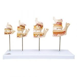 Dental Models