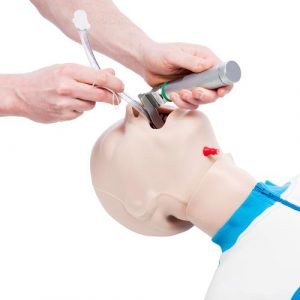 Airway Management