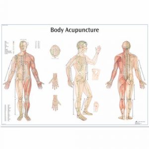 Acupuncture