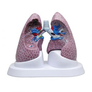 Lung Models