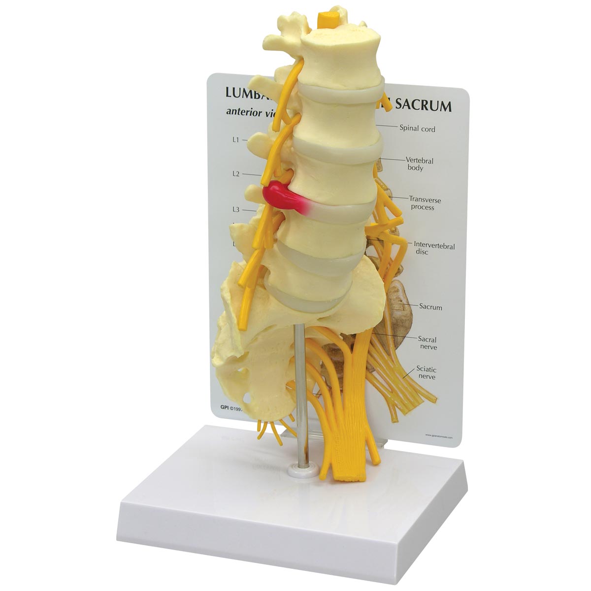 5 Piece Vertebrae with Sacrum Model - SEM Trainers