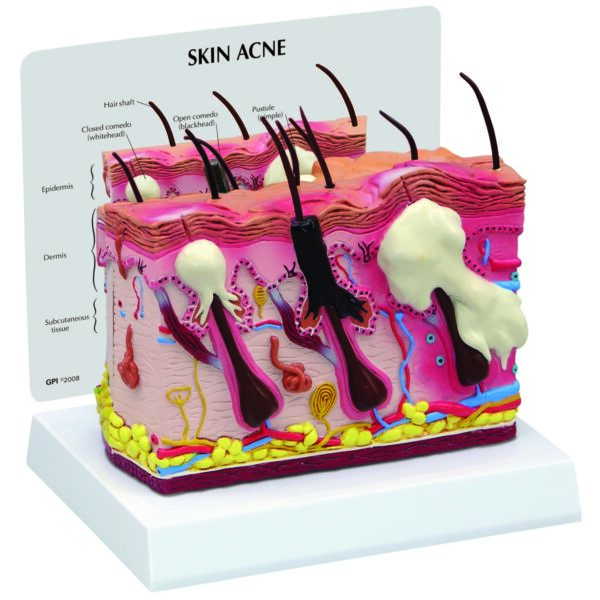 Skin Models Archives - SEM Trainers