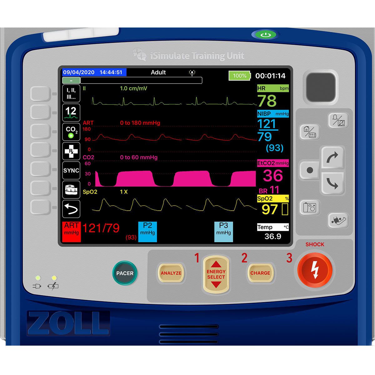 Zoll® X Series® Patient Monitor Screen Simulation for REALITi360 SEM