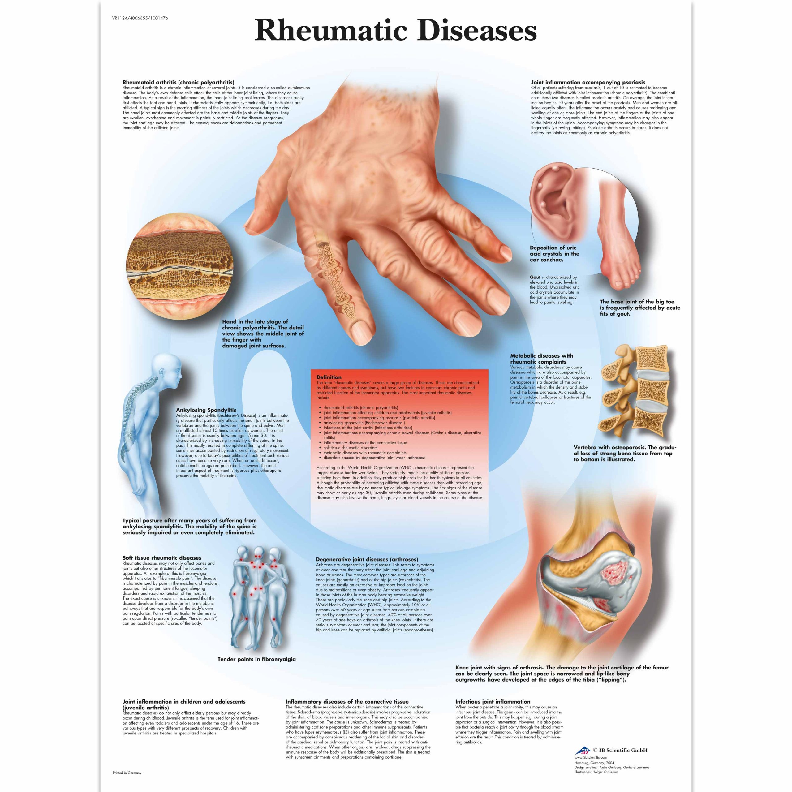 Rheumatic Diseases Chart SEM Trainers rheumatic-diseases-chart-sem-trainers