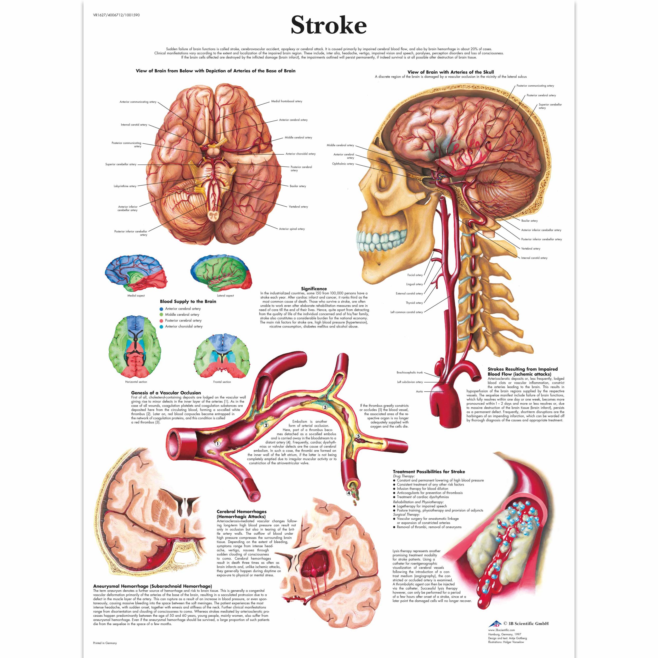 Stroke chart - sem trainers