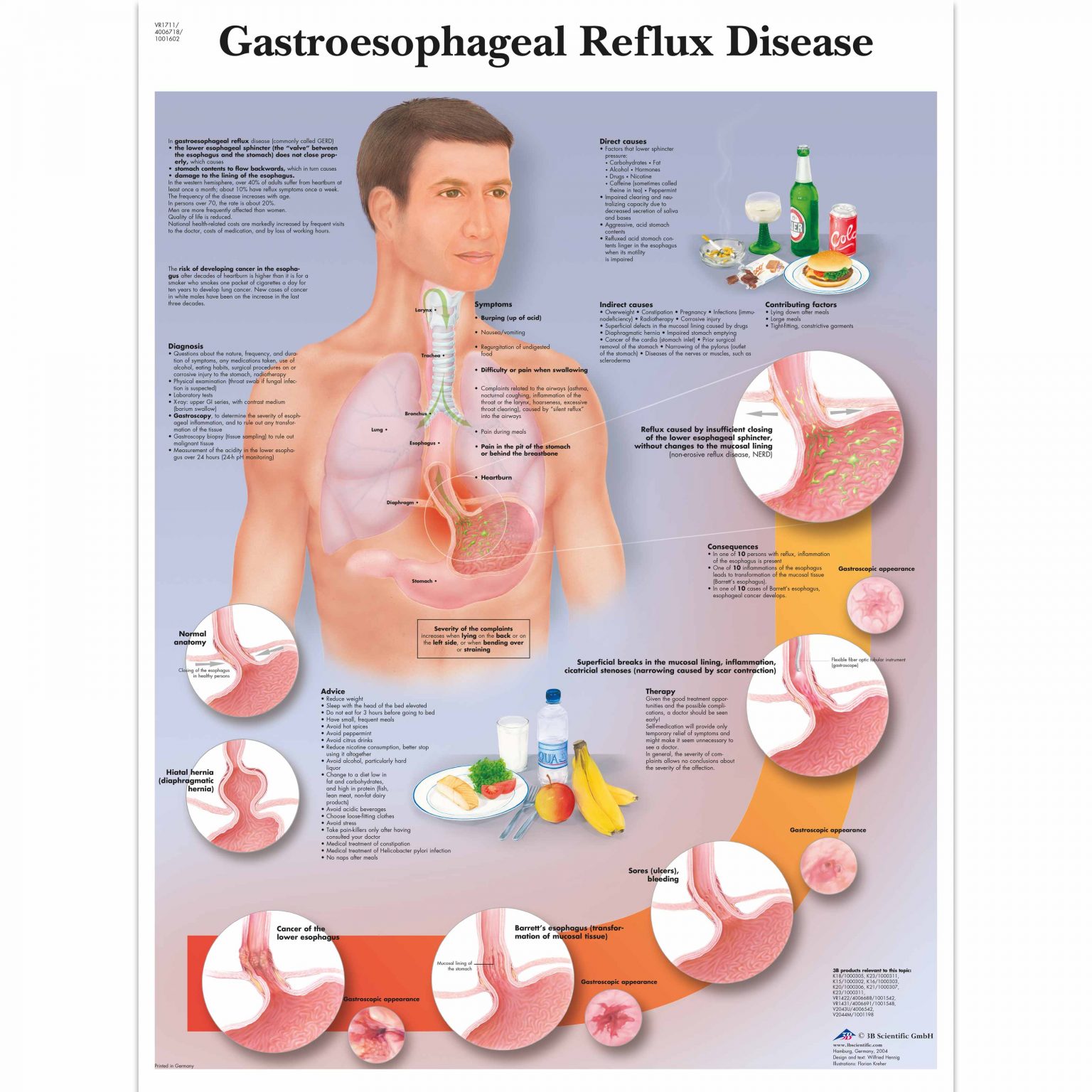 Diseases Of The Digestive System Anatomical Chart - Laminated 26x20 Inch